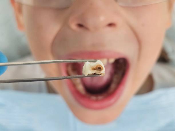Best Emergency Care for Gum Disease in Liolnton, NC